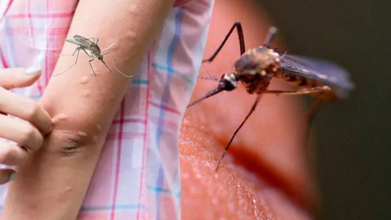 İşte  sivrisinekten  kurtulmanın yolları