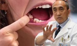 Japonya kaybolan dişler için ilaç geliştiriliyor