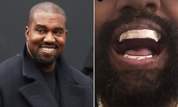 Kanye West 850 bin dolarlık titanyum diş yaptırdı: Kendisi tasarımı...