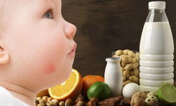 Gıda alerjisine yeni tedavi
