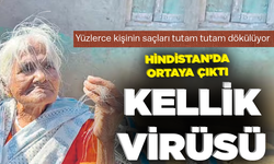 KELLİK VİRÜSÜ! Hindistan’da ortaya çıktı... Yüzlerce kişinin saçları tutam tutam dökülüyor