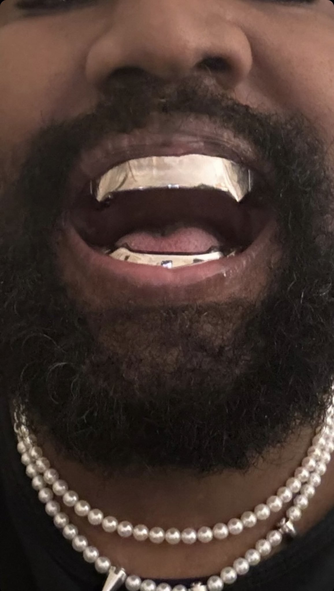 Kanye West'in dişleri sosyal medyanın dilinde