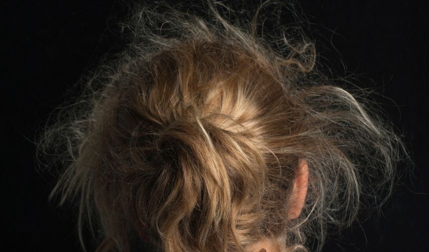 Saç Neden Kabarır Kabarması Nasıl Önlenir (3)