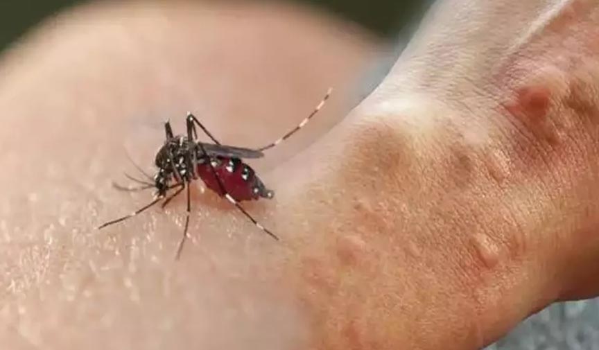 sivri sinekten kurtulmanın yöntemleri