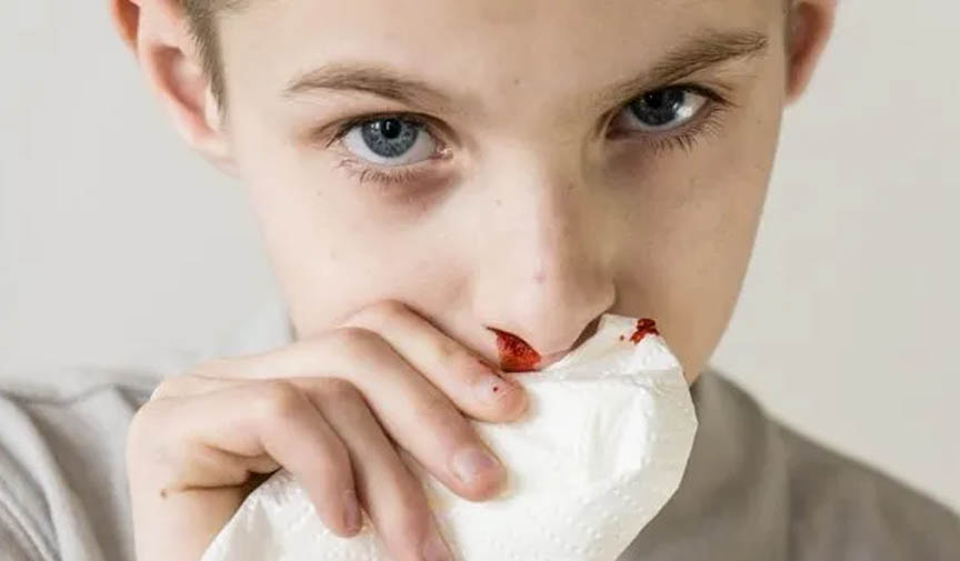 Çocuklarda hemofili  burun kanaması nedir