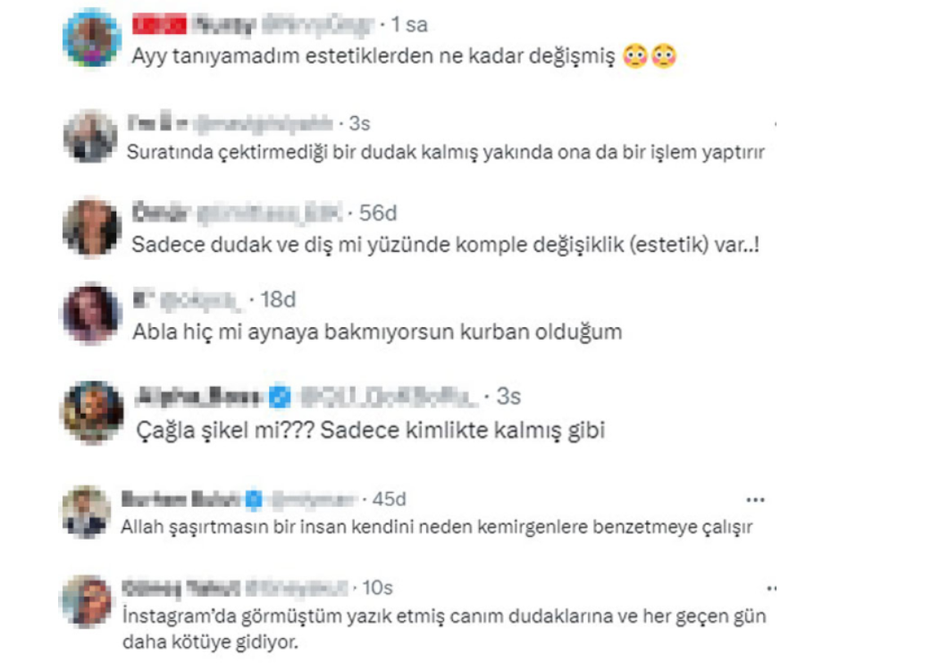 Çağla Şıkel'in estetiği alay konusu oldu